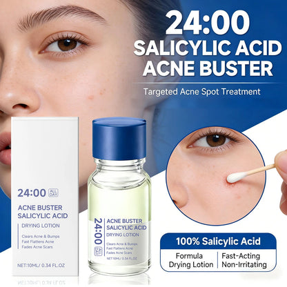 Salicylic Acid Drying Lotion Face Serum with Cotton Swab– Reduce Pimples & Breakouts Fade Acne Scars Minimize Pores Skin Renewal